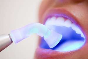 Zoom Teeth Whitening in Astoria Queens