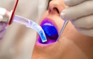 Laser Dentistry Procedures NYC