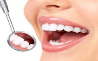 Teeth Whitening in Queens