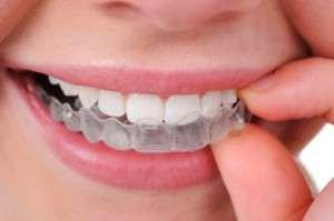 Orthodontist in Astoria Queens